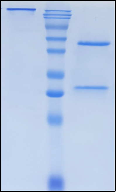 (Ustekinumab)Biosimilar Reference Antibody