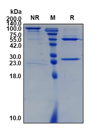 (Vorsetuzumab)Biosimilar Reference Antibody(TNFSF7/CD70/CD27LG)(CAS NO:1165740-62-4)
