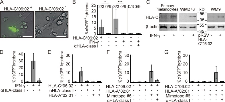 ADAMTS-like protein 5