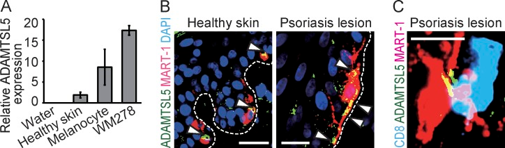 ADAMTS-like protein 5