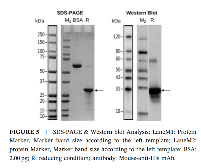 ADAMTS-like protein 5