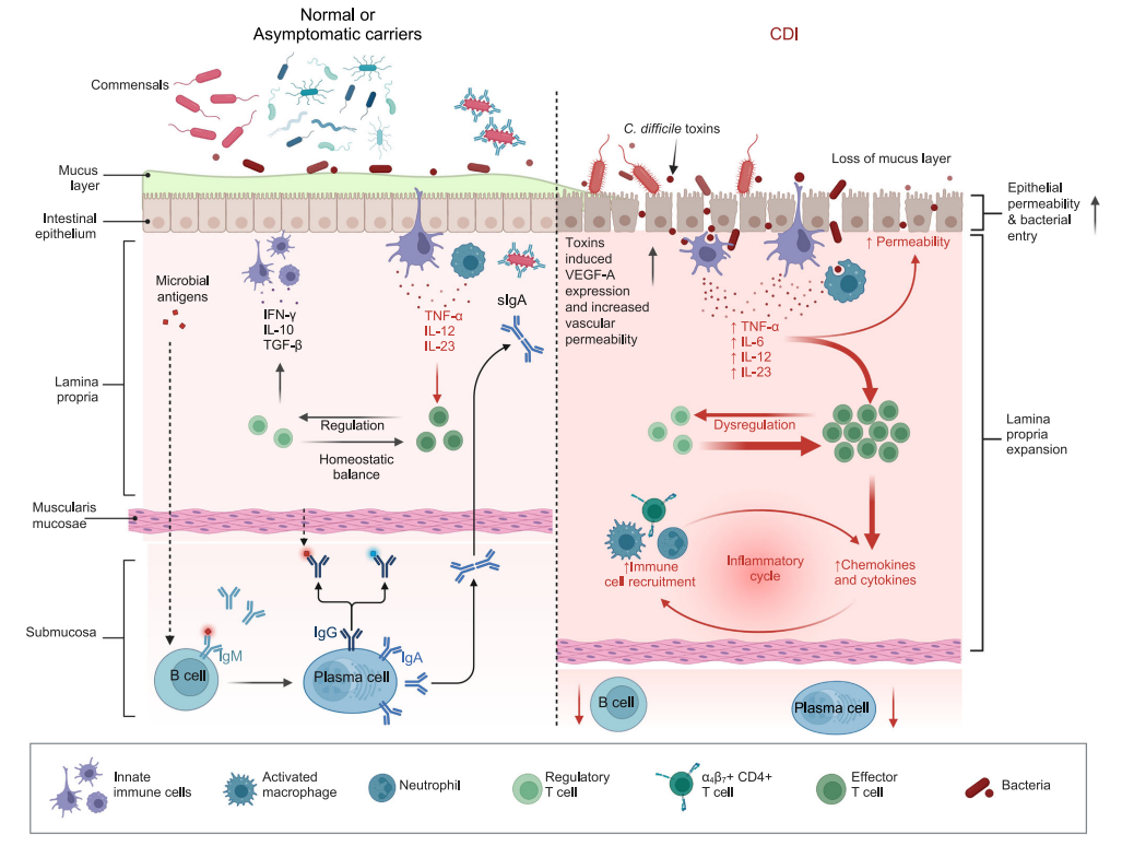 Clostridium difficile infection with toxins Toxin-A and-Toxin-B Clostridium difficile infection with toxins Toxin-A and-Toxin-B