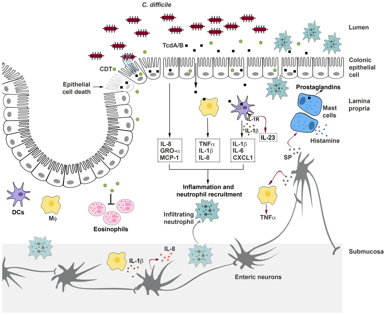 Clostridium difficile infection with toxins Toxin-A and-Toxin-B Clostridium difficile infection with toxins Toxin-A and-Toxin-B