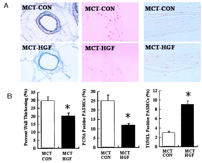 Hepatocyte growth factor HGF Hepatocyte growth factor HGF