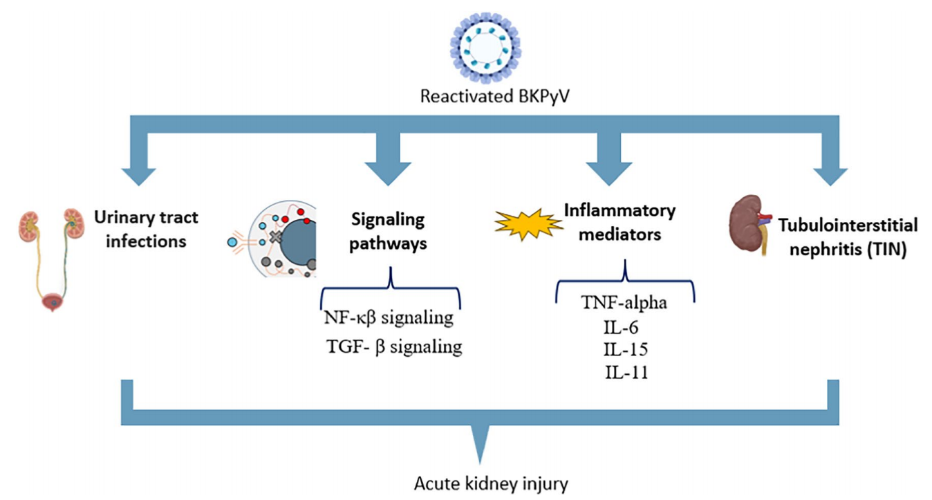 Polyomavirus BKV