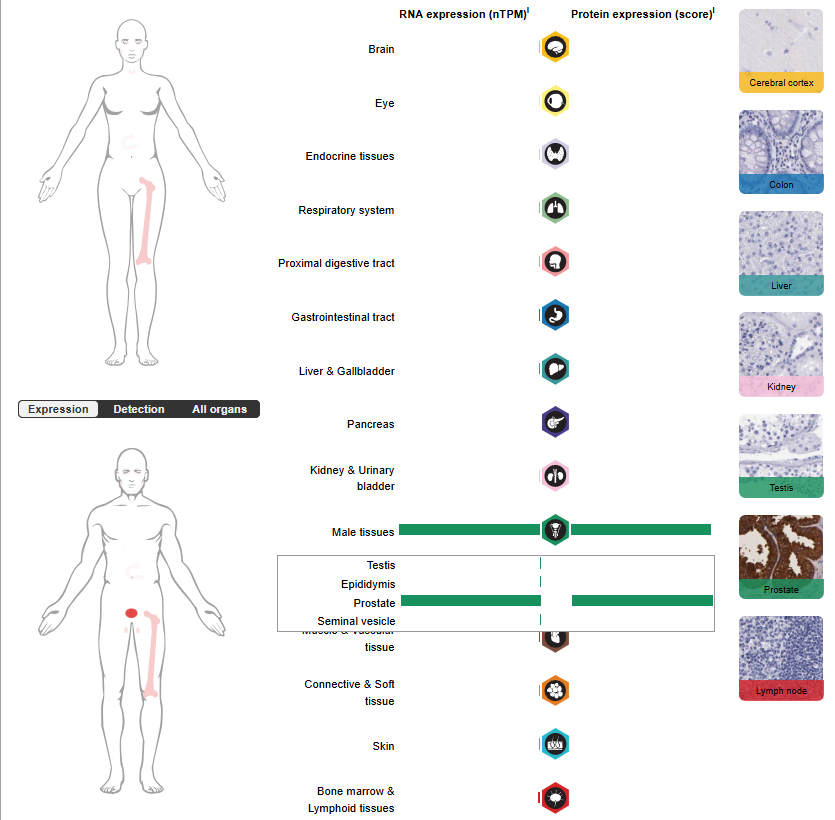 Prostate cancer therapeutic target KLK2 Prostate cancer therapeutic target KLK2