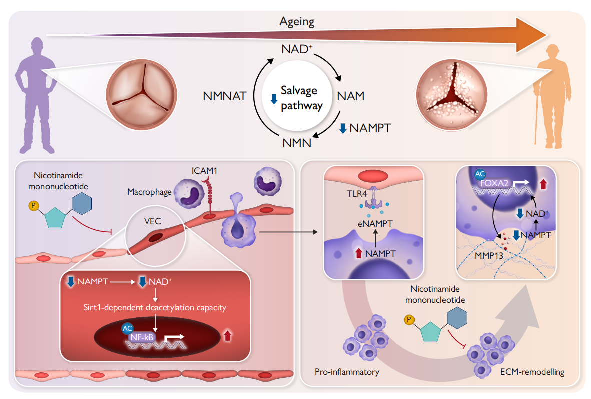 Senescence-associated metabolic alterations aggravate calcific aortic valve disease