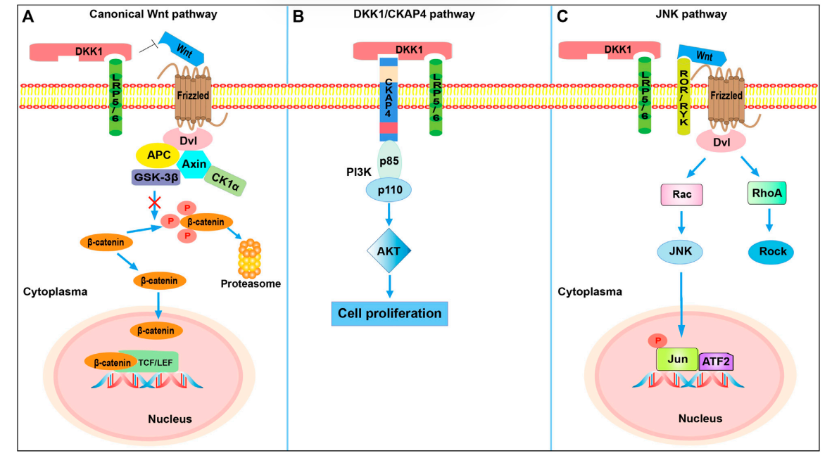 DKK1 is the core accomplicker of tumor immune escape DKK1 is the core accomplicker of tumor immune escape