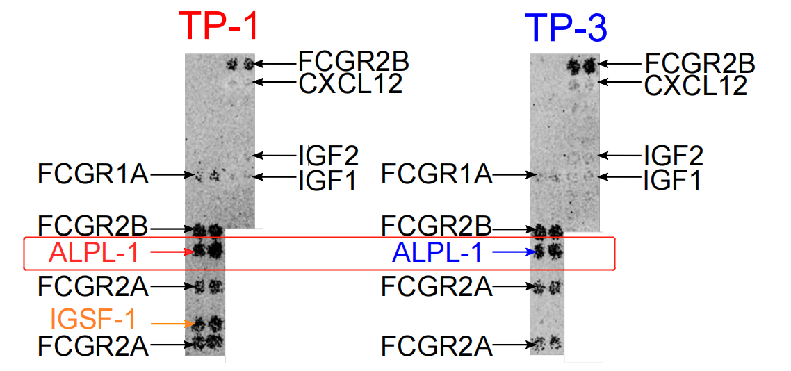 Literature share antibody sequences defined a new target for osteosarcoma CAR-T therapy Literature share antibody sequences defined a new target for osteosarcoma CAR-T therapy