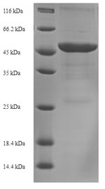 Recombinant Acinetobacter baumannii Outer membrane protein Omp38(omp38)