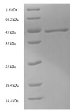 Recombinant Aequorea victoria Green fluorescent protein(GFP)