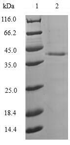 Recombinant Aequorea victoria Green fluorescent protein(GFP)