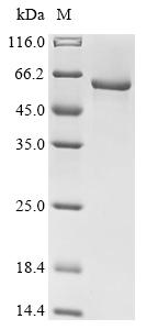Recombinant Arabidopsis thaliana At1g09870/F21M12_26(At1g09870)