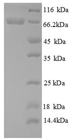 Recombinant Aspergillus niger Glucose oxidase(gox),partial