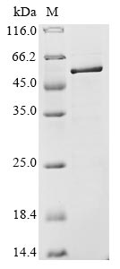 Recombinant Avian infectious bronchitis virus Nucleoprotein(N)