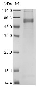 Recombinant Avian infectious bronchitis virus Nucleoprotein(N)