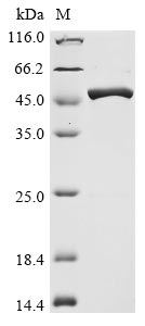 Recombinant Avian infectious bronchitis virus Nucleoprotein(N)