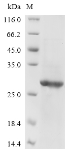 Recombinant Avian infectious bronchitis virus Spike glycoprotein(S),partial