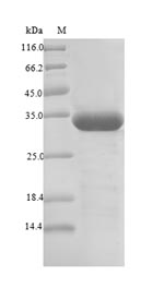 Recombinant Betula pendula Major pollen allergen Bet v 1-A(BETVIA)