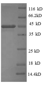 Recombinant Bordetella pertussis Pertactin autotransporter(prn),partial