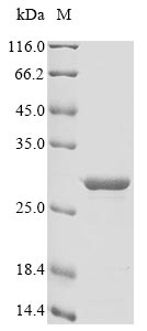 Recombinant Bovine Allograft inflammatory factor 1(AIF1)