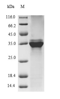 Recombinant Bovine Protein S100-A9(S100A9)