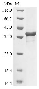 Recombinant Brugia malayi tRNA (guanine-N(7)-)-methyltransferase(Bm1_01445)