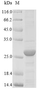 Recombinant Cat Serum amyloid A protein(SAA1),partial 