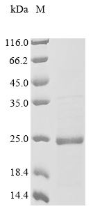 Recombinant Chicken Midkine(RIHB)