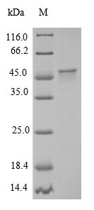 Recombinant Chicken Myosin light chain kinase, smooth muscle(Mylk),partial
