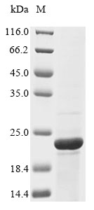 Recombinant Chicken Osteocalcin(BGLAP)