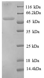 Recombinant Chicken Tubulin beta-1 chain,partial