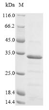 Recombinant Chicken anemia virus Apoptin(VP3)