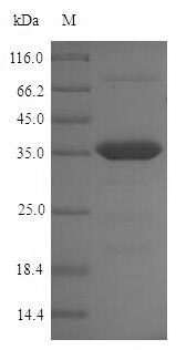 Recombinant Chlamydia trachomatis Large cysteine-rich periplasmic protein OmcB(omcB),partial