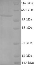 Recombinant Chlamydia trachomatis Major outer membrane porin, serovar A(ompA)