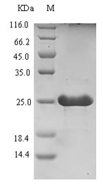 Recombinant Clostridium pasteurianum Rubredoxin