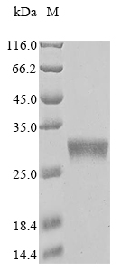 Recombinant Corynephage omega Diphtheria toxin,partial