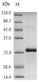 Recombinant Coturnix delegorguei Ovomucoid,partial