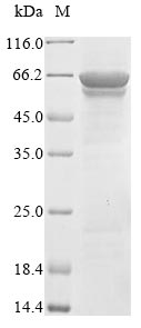 Recombinant Crimean-Congo hemorrhagic fever virus Nucleoprotein(N)