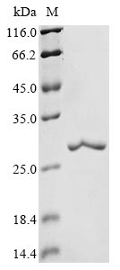 Recombinant Dictyostelium discoideum Nucleoside diphosphate kinase, cytosolic(ndkC-1)