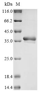 Recombinant Dirofilaria immitis Pepsin inhibitor Dit33(DIT33)