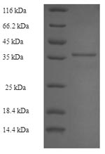 Recombinant Epstein-Barr virus Latent membrane protein 1(LMP1),partial