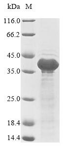 Recombinant Epstein-Barr virus Latent membrane protein 1(LMP1),partial