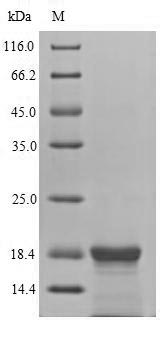 Recombinant Epstein-Barr virus Latent membrane protein 2(LMP2),partial