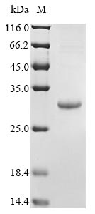 Recombinant Epstein-Barr virus Secreted protein BARF1(BARF1)