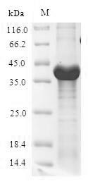 Recombinant Escherichia coli  UDP-3-O-acyl-N-acetylglucosamine deacetylase(lpxC)
