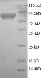 Recombinant Escherichia coli Aerobic glycerol-3-phosphate dehydrogenase(glpD)