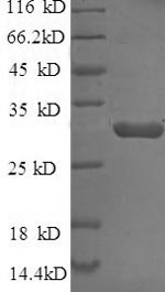 Recombinant Escherichia coli Beta-lactamase CTX-M-1(bla)