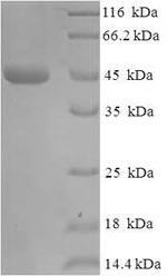 Recombinant Escherichia coli Beta-lactamase TEM(bla) 