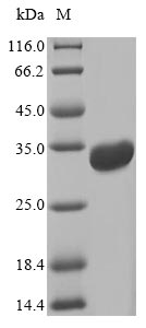 Recombinant Escherichia coli Heat-labile enterotoxin A chain(eltA)